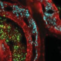 GAS (green) in the nasal mucosa, surrounded by T cells (light blue)